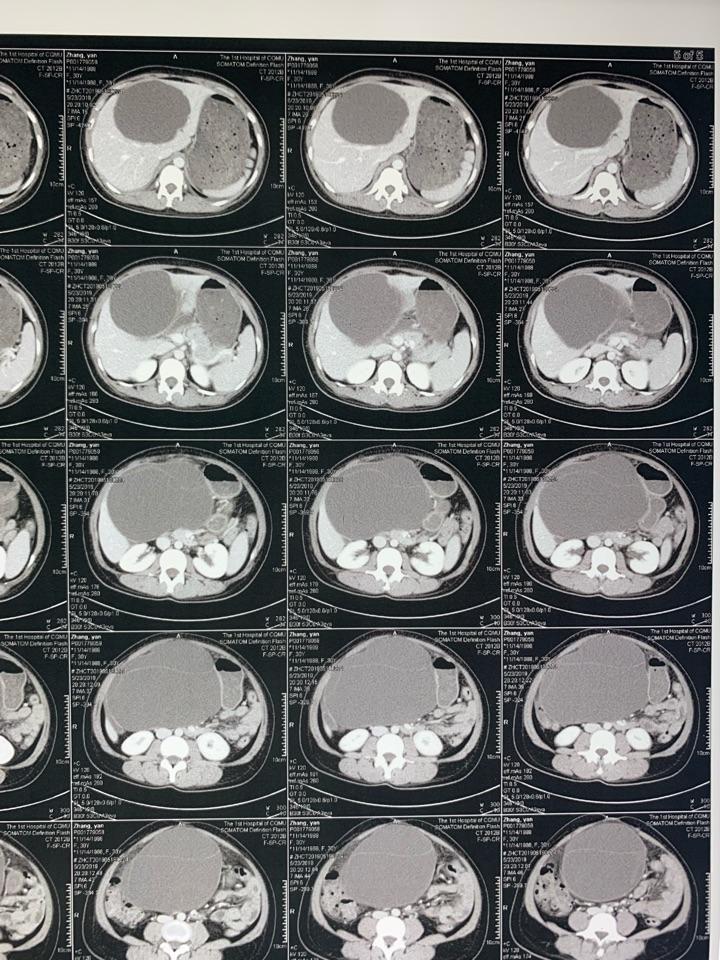 kUs271694837?whs=828_1104