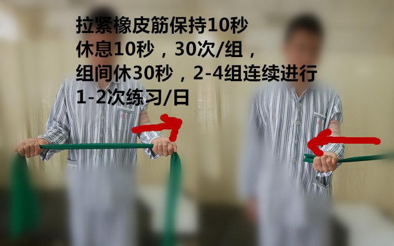 锁骨骨折术后康复