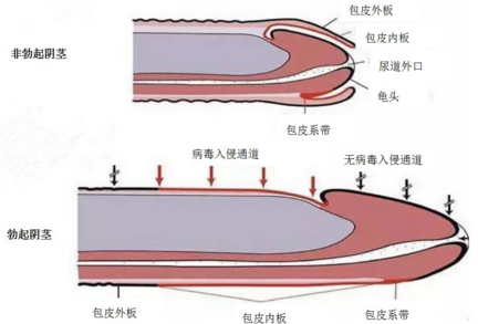 儿童包皮那些事儿(小儿包茎,包皮过长的诊治)_牛之彬医生文章_中国
