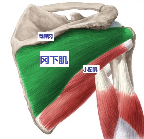 e型巨大肩袖撕裂:冈上肌肌腱撕裂 冈下肌肌腱撕裂 小圆肌肌腱撕裂.