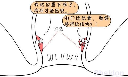 痔疮手术会看到隐私吗图片