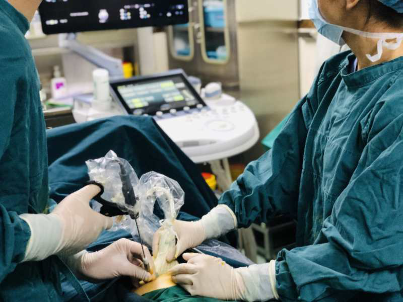 双极电凝减胎术,心脏穿刺氯化钾减胎术,手术娴熟,保留胎儿存活率在