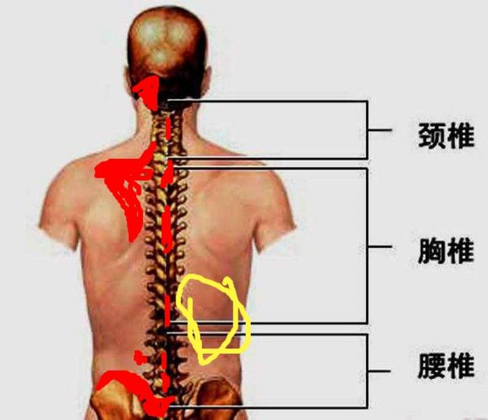 常見脊柱軟組織疼痛部位示意圖