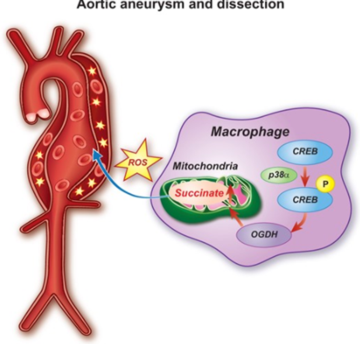 中米两国研究人员鉴定出主动脉瘤和夹层的生物标志物和治疗靶点