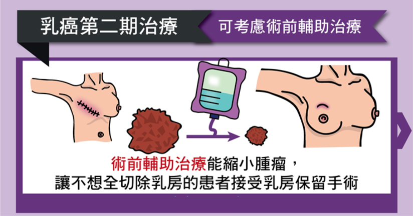 得了2期乳癌怎么办 先别慌 手术治疗也很有效 健康号 微医