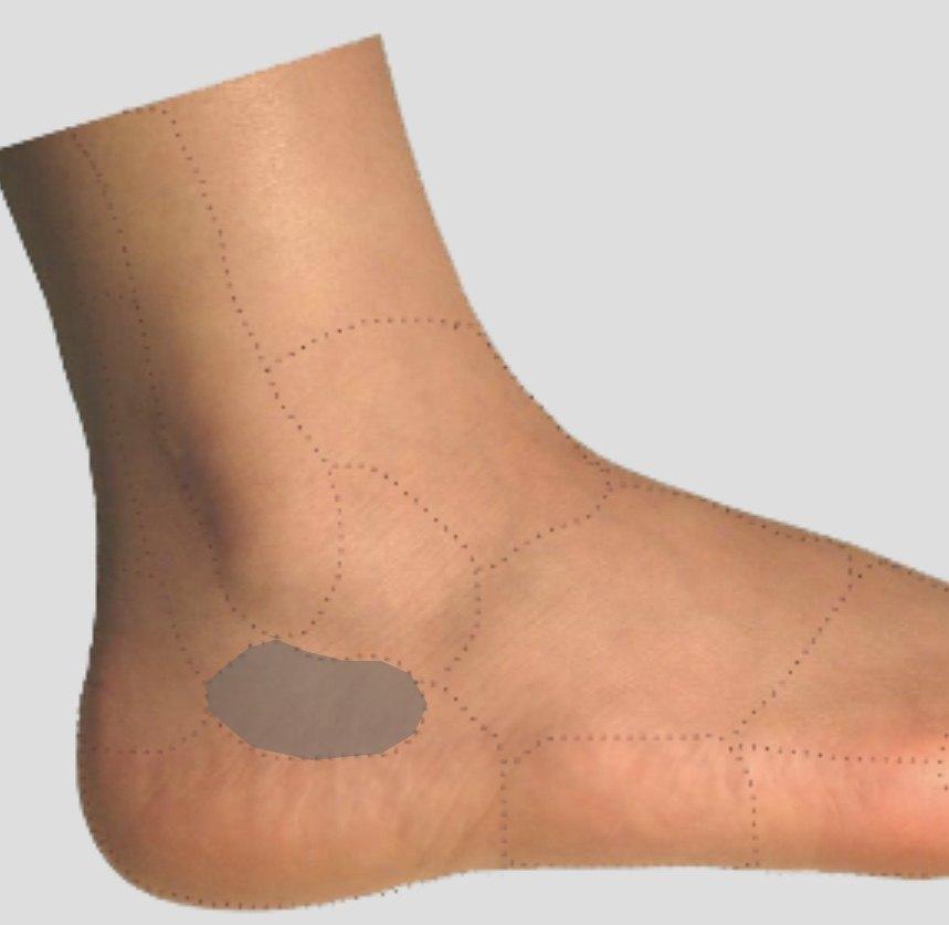 足踝教育篇-疼痛居家自查(三)足外侧面