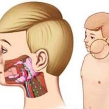 小儿腮腺炎传染期