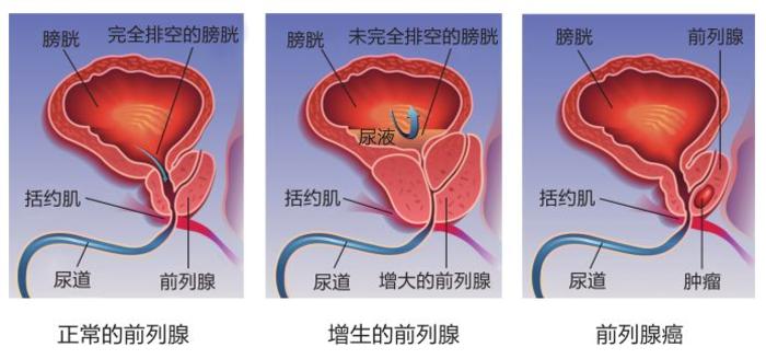 lkl262086009?resize=700:x