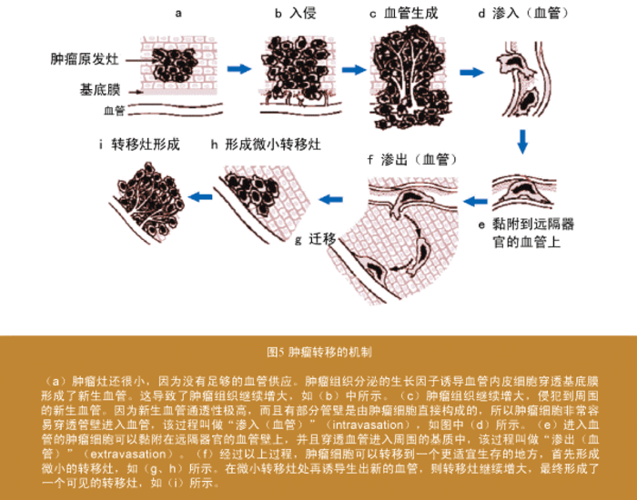 乳腺癌有哪些主要的转移途径