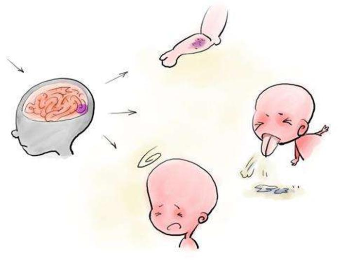 脑膜炎的症状与病因