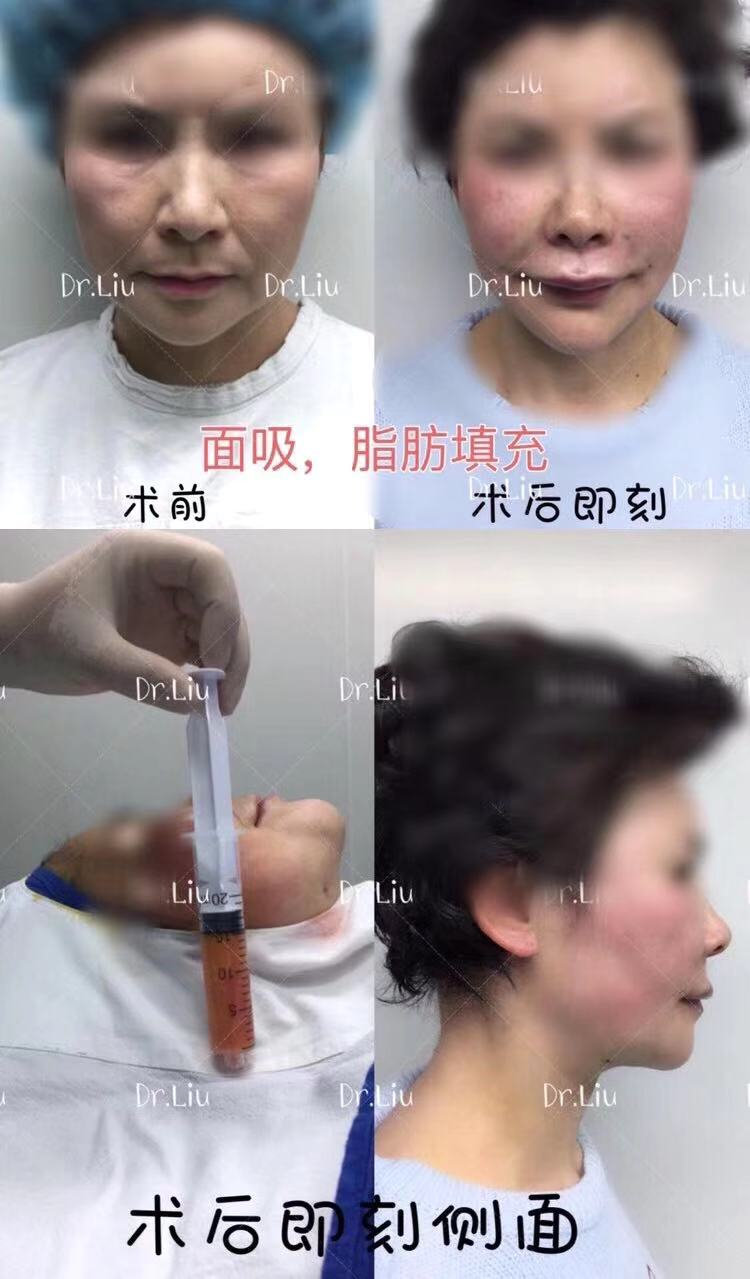 脸怎么变瘦 脸变瘦的方法