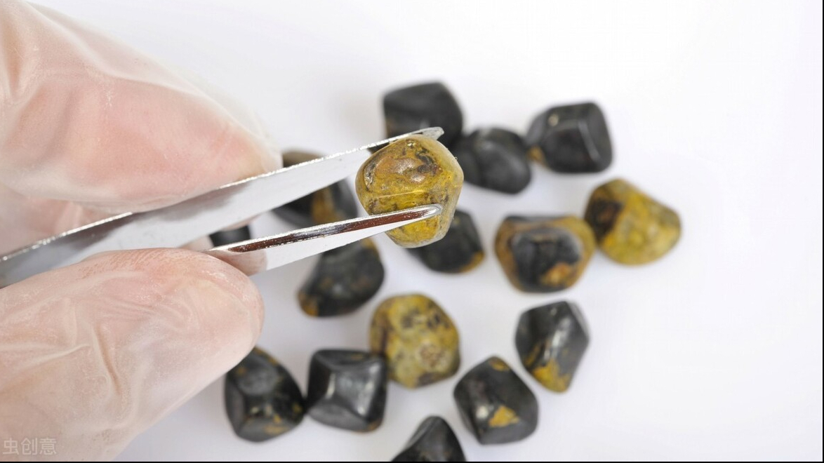 怎么知道自己得了胆固醇结石还是胆色素结石