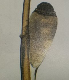 难言的外生殖器皮肤病之阴虱