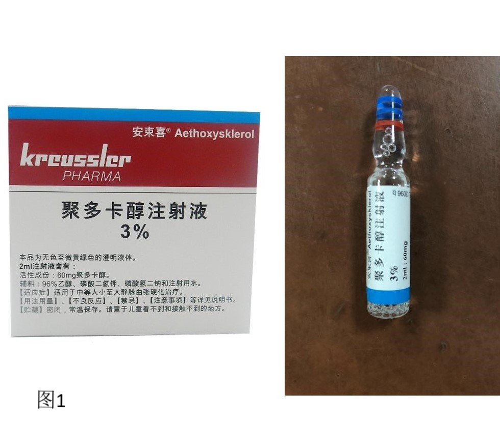 硬化剂治疗儿童血管畸形