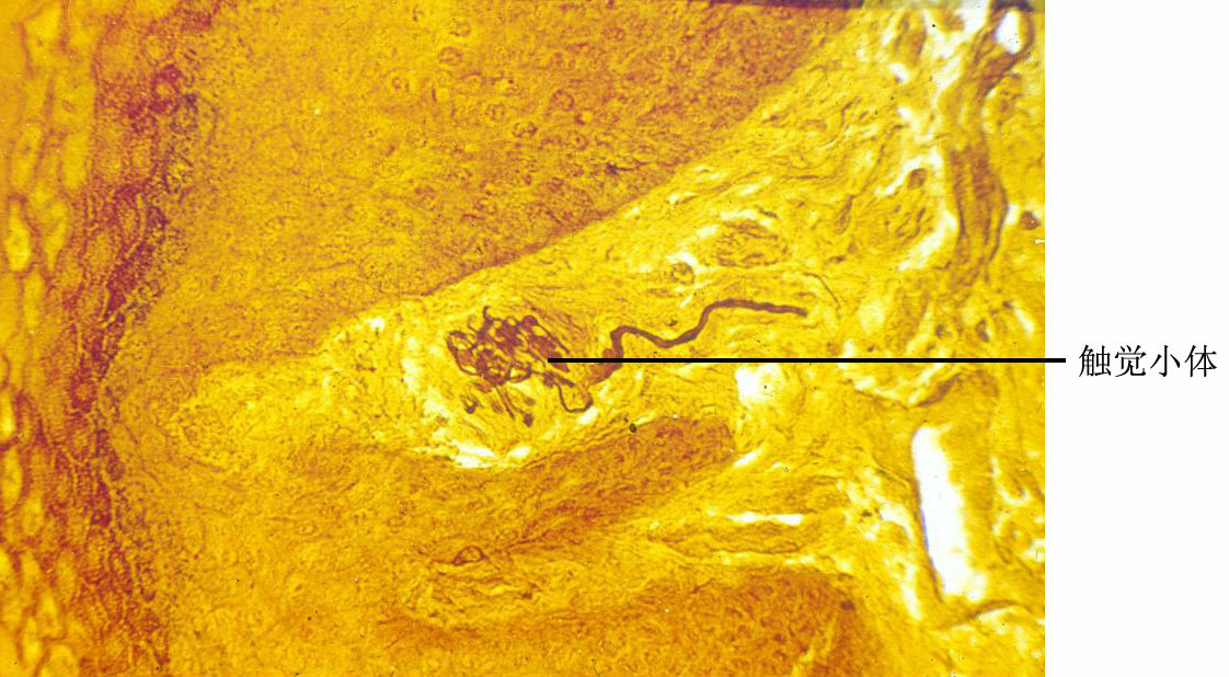 (1)触觉小体(tactile corpuscle):又称梅氏小体(meissner corpuscle)
