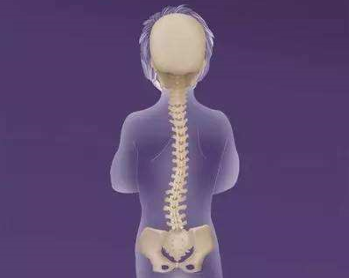 儿童脊柱侧弯症状有哪些家长们快来了解一下