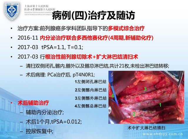 總結多西他賽用於前列腺癌化療的歷史經歷了由去勢抵抗性前列腺癌向