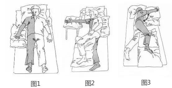 偏瘫患者正确的睡觉姿势