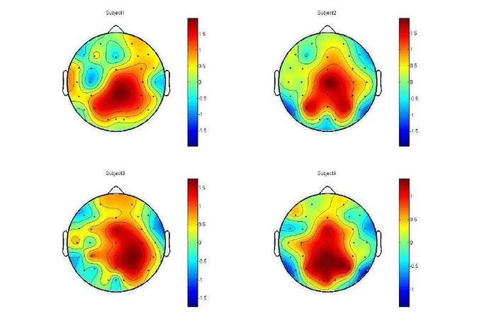 民医生说:脑电地形图_魏民医生文章_上海市儿童医院普陀新院-微医