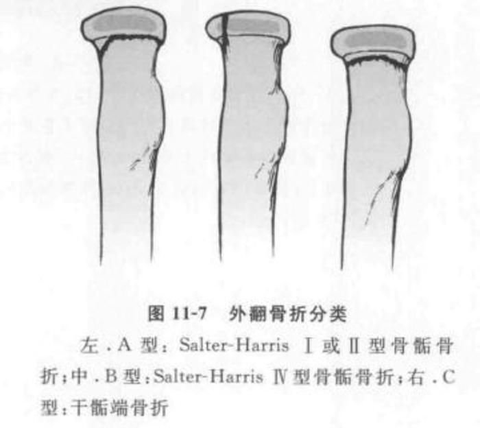 oTV192420966?resize=700:x