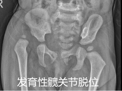 psa398521686