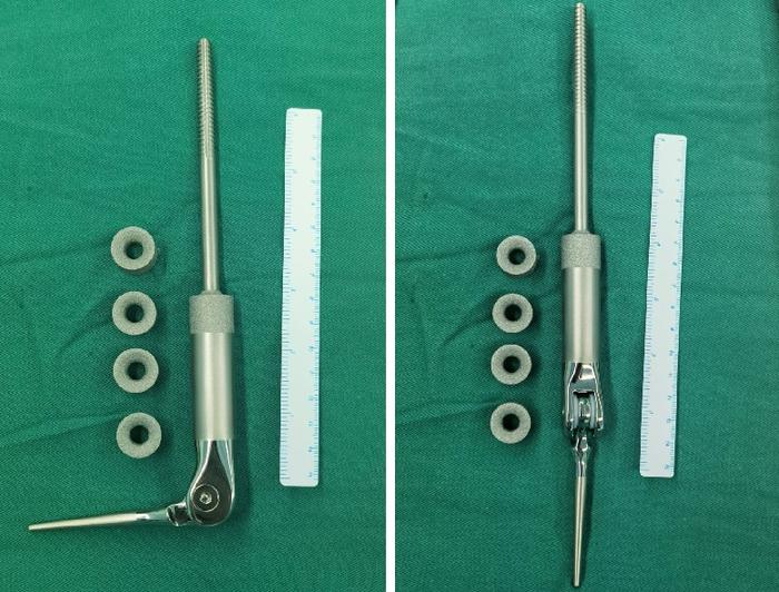 典型病例肿瘤型肘关节假体治疗肱骨远段病理性骨折