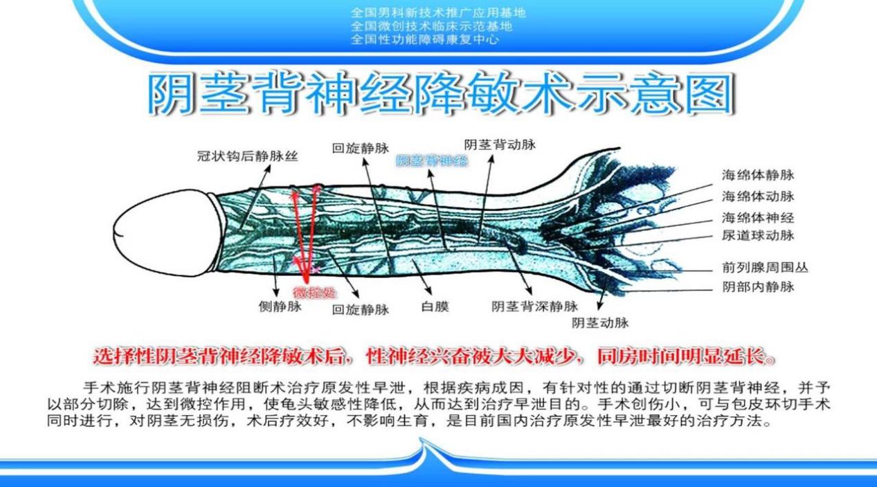 海绵体年轻化的综合诊治
