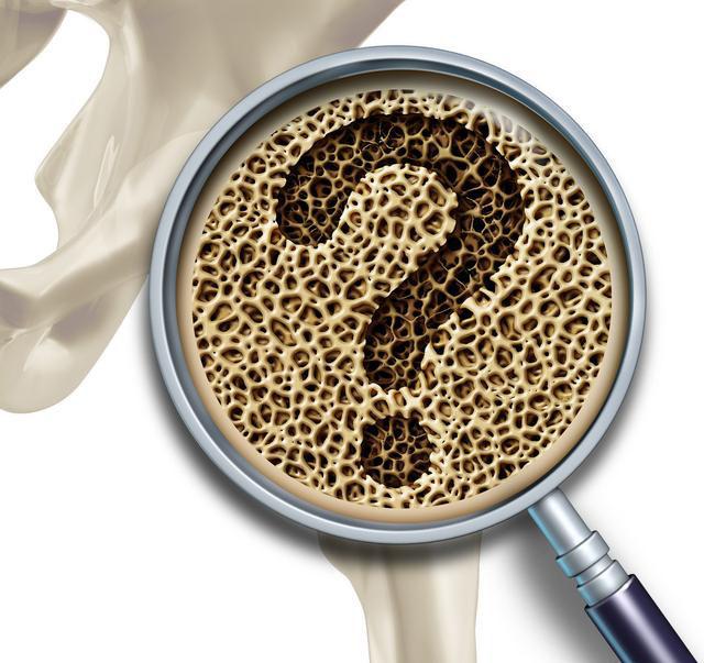 骨头汤补钙越补越坏关于骨质疏松补钙的错误观点和正确知识