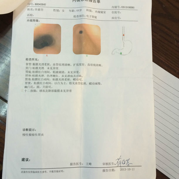 膏方治療萎縮性胃炎患者的胃鏡病理前後對照圖片