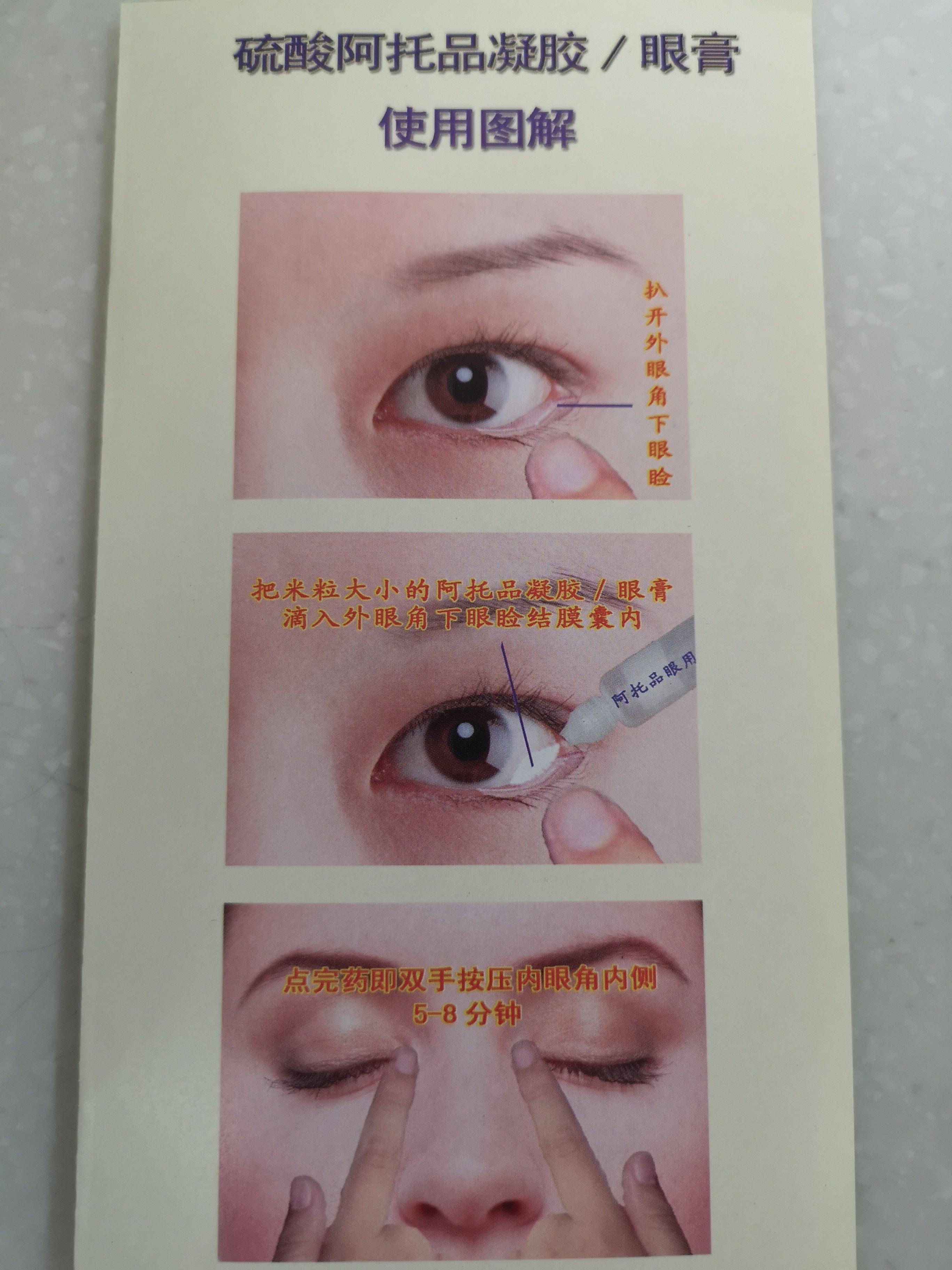 然后扒开下眼皮,形成一个小袋子的状态,这里是我们的结膜囊,将眼药水