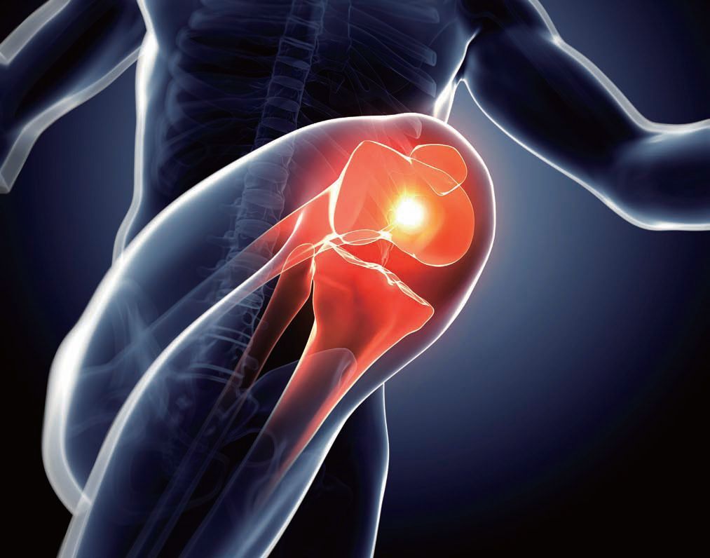 骨关节炎膝骨关节炎不同治疗手段之间的取舍