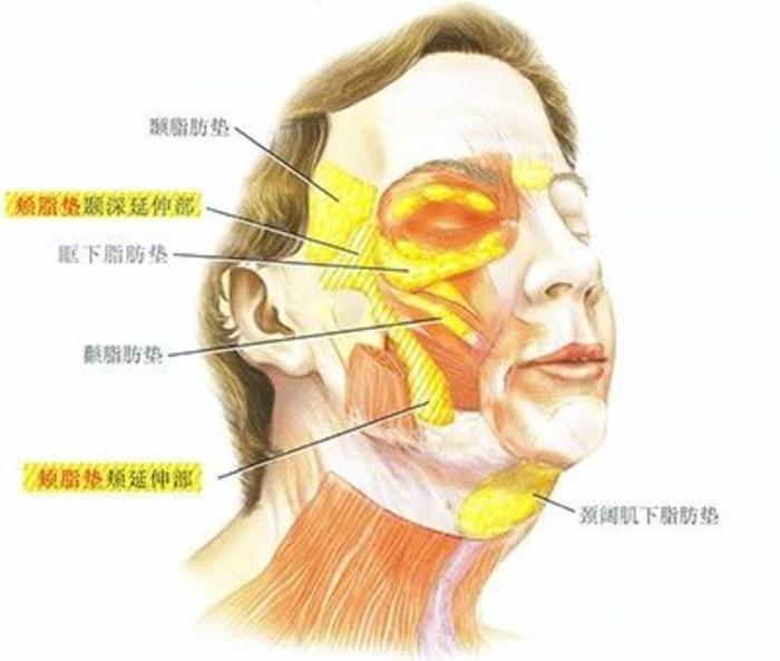 其收紧所用会减弱并导致内容物(颈阔肌下脂肪垫等)出现重力性袋状下垂