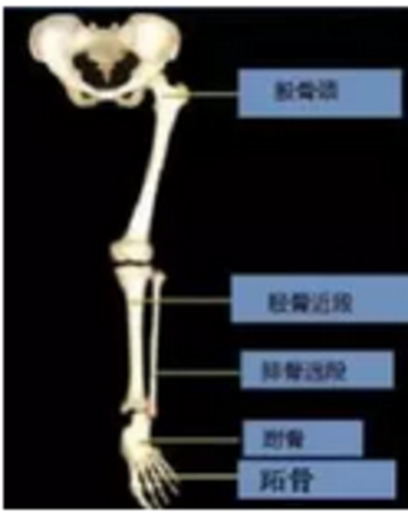 影像检查 疲劳性骨折的影像学表现诊断 健康号 微医