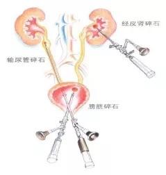 s9w271406935?whs=828_873