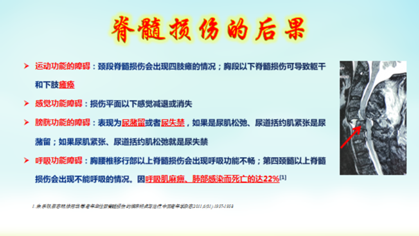 什么是脊髓损伤 脊髓损伤有哪些危害 脊髓损伤该怎么治疗 健康号 微医