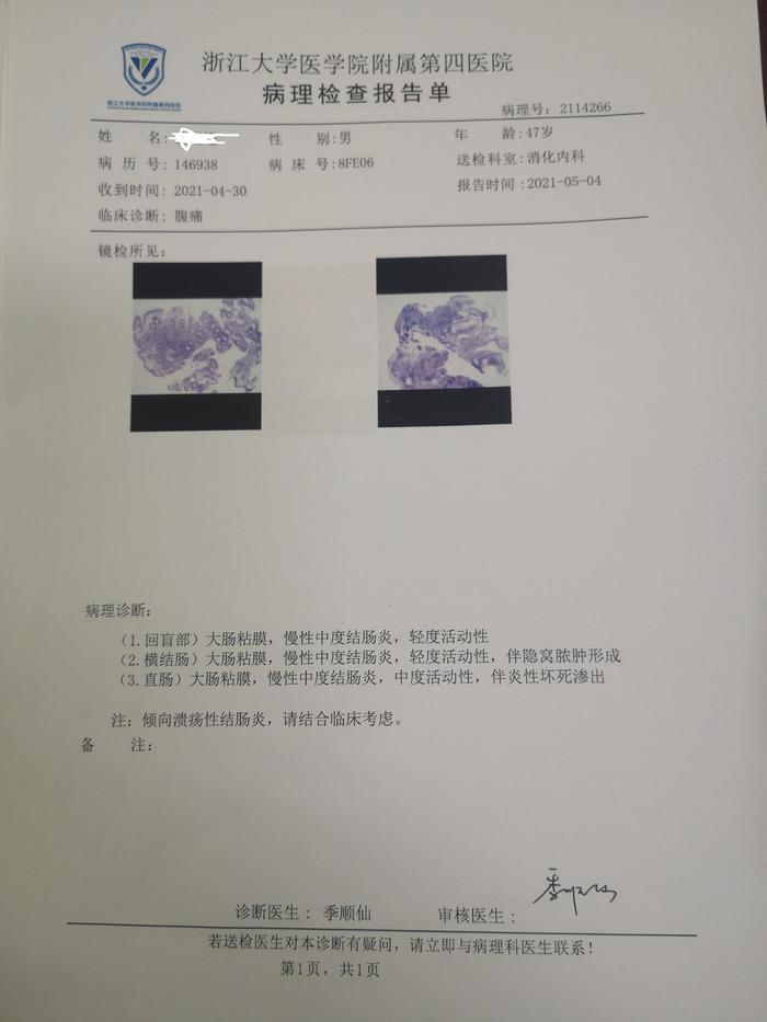 青玉散对于血便脓血便的溃疡性结肠炎疗效确切附近期重度全结肠uc患者