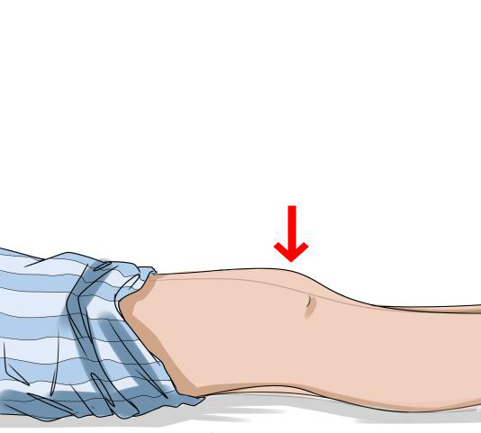 股四头肌等长收缩:在仰卧位下,绷紧大腿前方肌肉,将膝盖往下压紧床面
