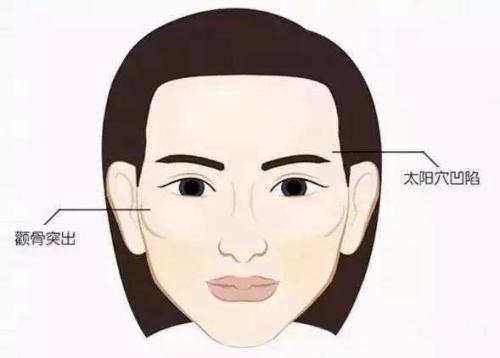 什么是颧骨缩小手术适合哪些人