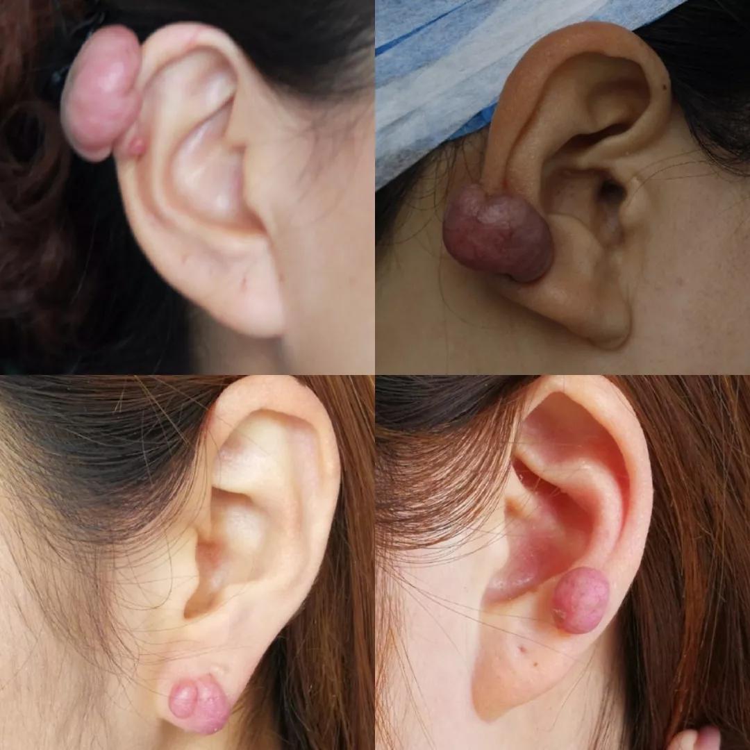 看整形外科还是其他科室看这篇就够了