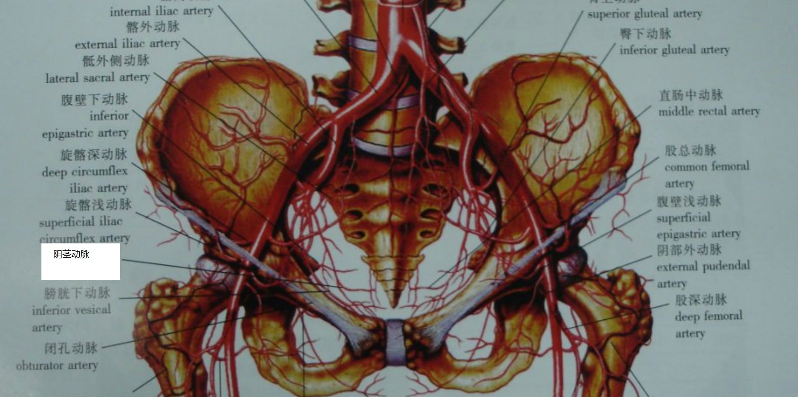 盆腔供血模式图主髂动脉闭塞ct二维重建影像主髂动脉闭塞,可见大量