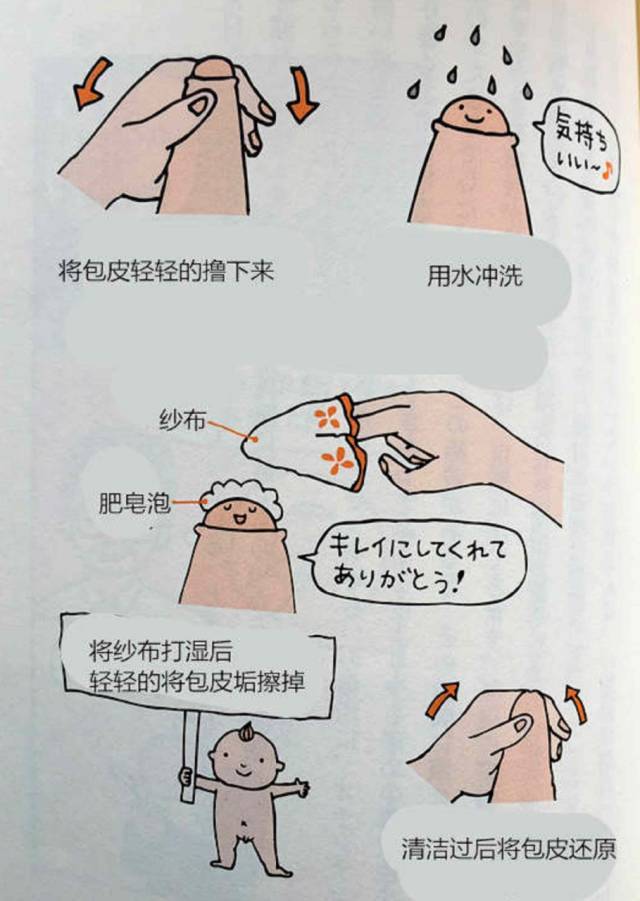 娃娃包皮长不长割不割看完你就晓得