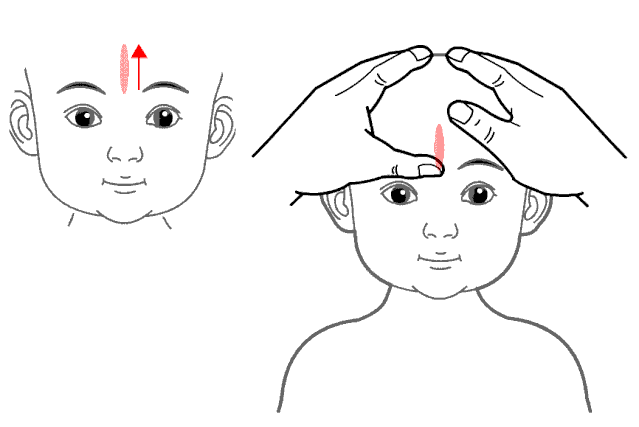 过敏性鼻炎中医治疗有何妙招
