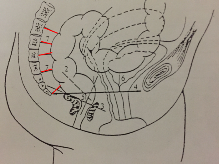骶神经调节术教程(19)——排粪造影检查