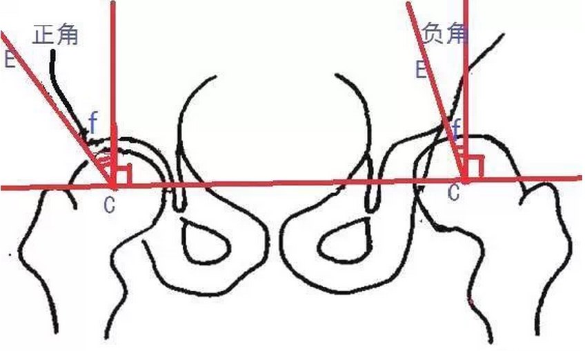 骨科读片骨盆x线平片解读