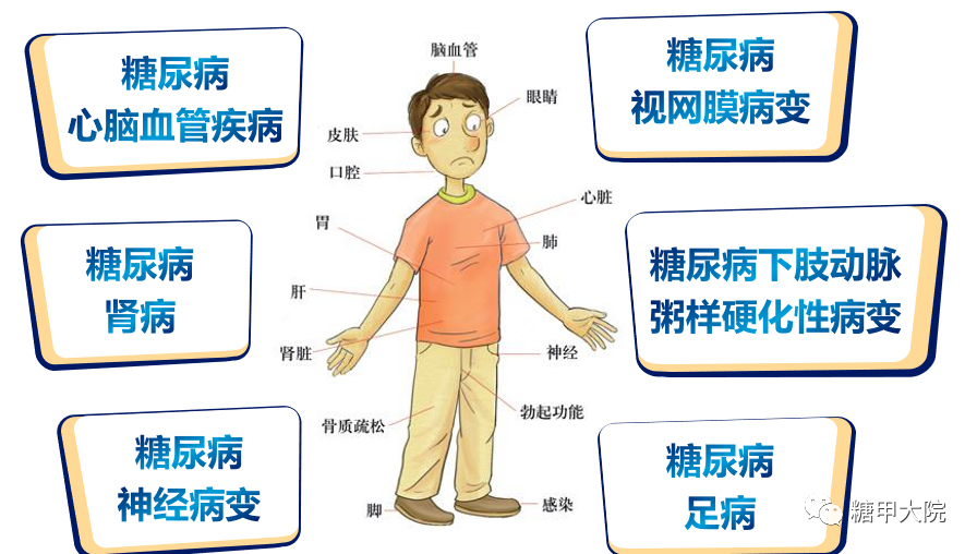 糖甲科普:李医生,得了糖尿病并发症,还有救吗?