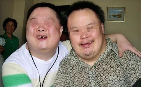 唐氏综合征的患儿,特点鲜明,主要有以下特征:先天智力低下(精神发育