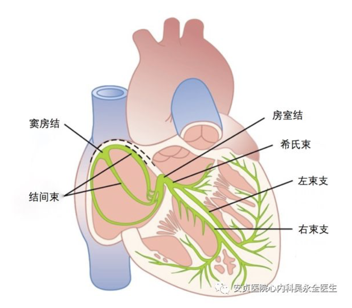 心动过缓与心脏起搏器