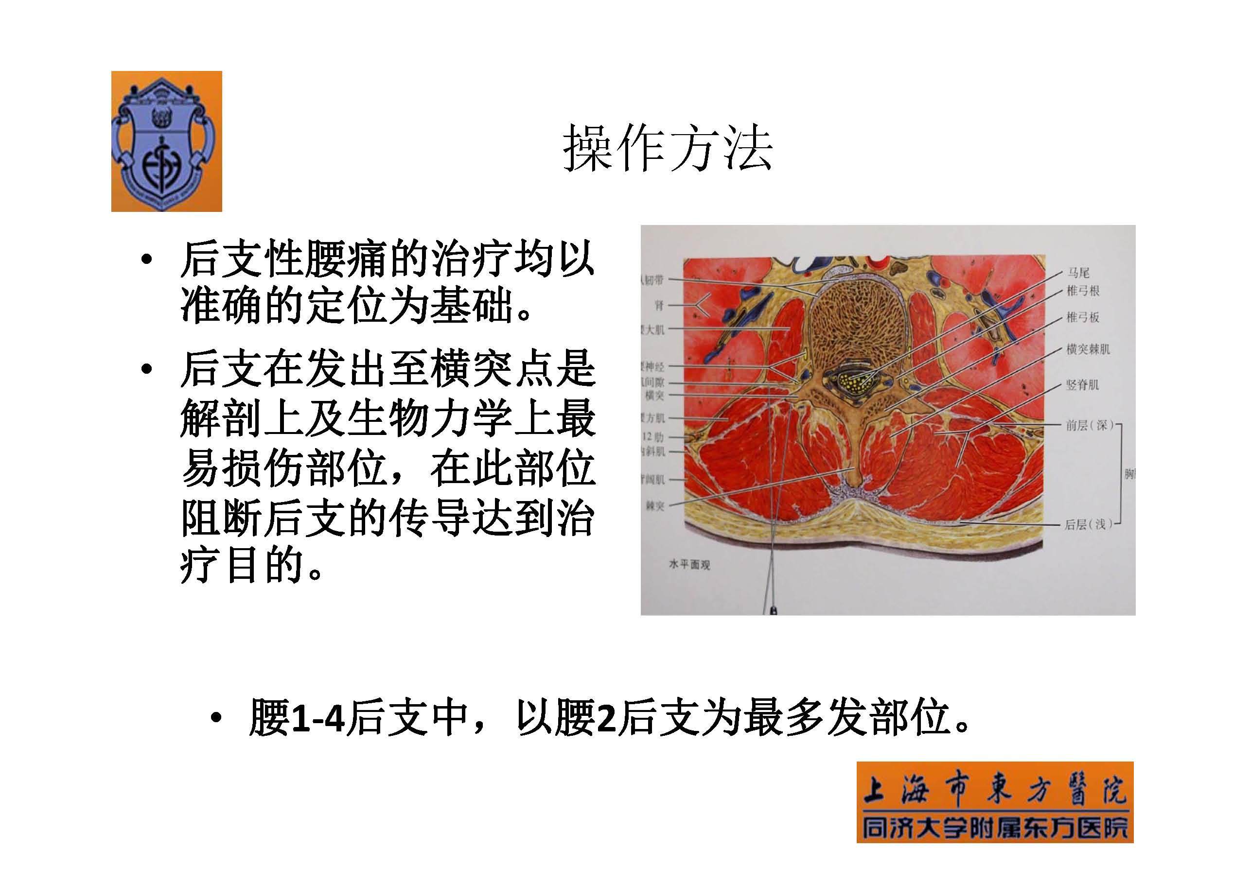 实用腰椎椎旁神经阻滞