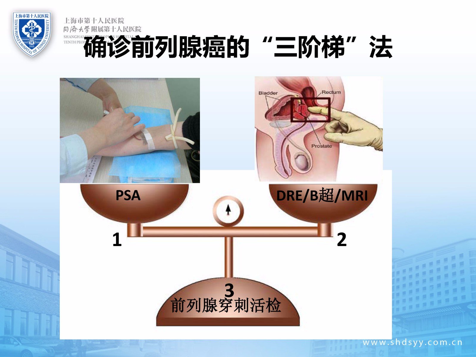 前列腺癌早期诊断的融合靶向精准穿刺活检(实战病例)