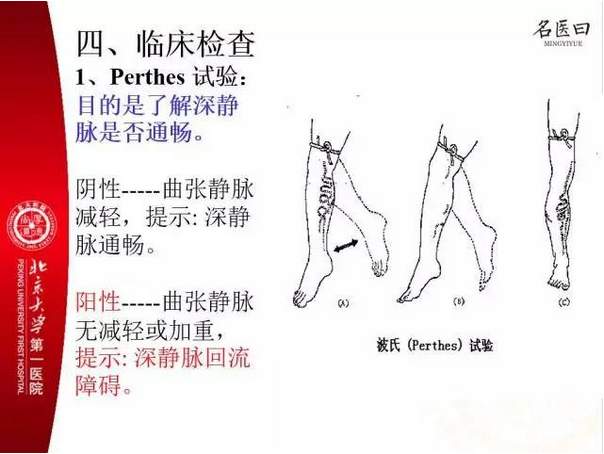 后曲张没有减轻,反而加重,就提示深静脉回流不畅,perthes实验为阳性